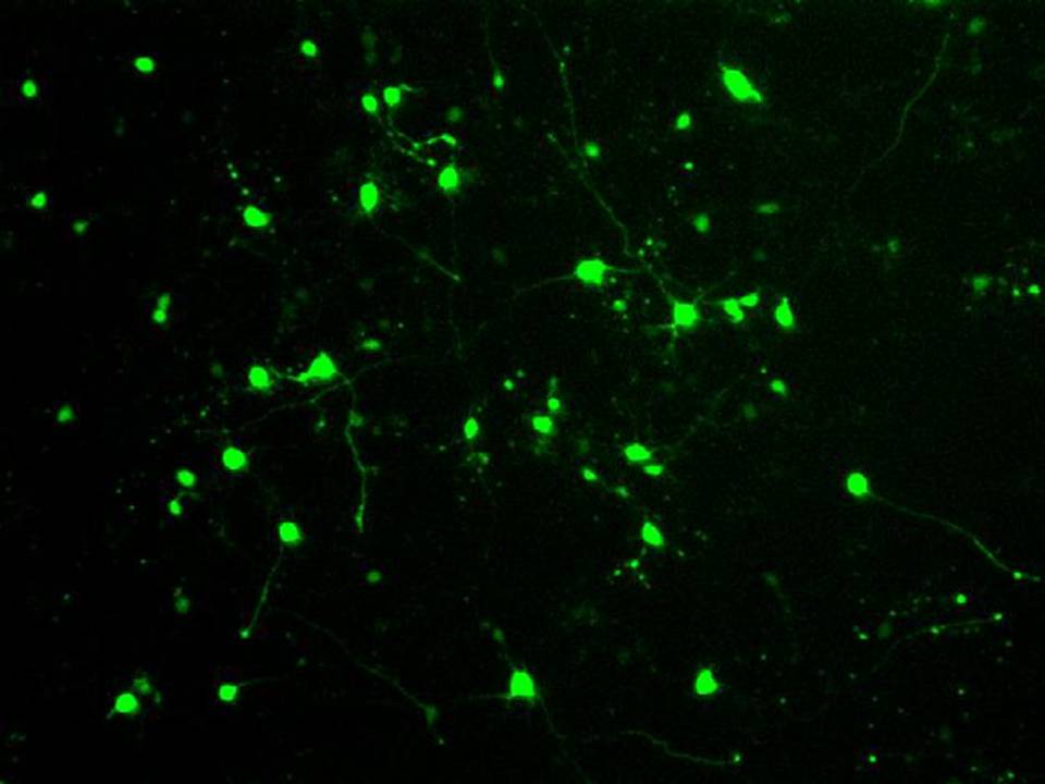 Primary - Rat Neurons in Adherence - Transfection Efficiency 60 per cent